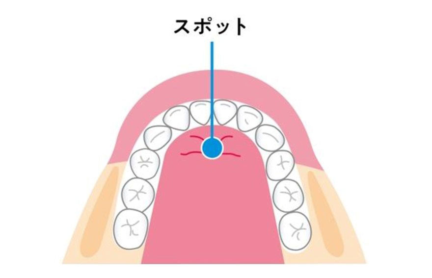 STEP01.審査