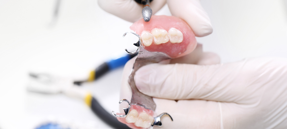 入れ歯治療とは