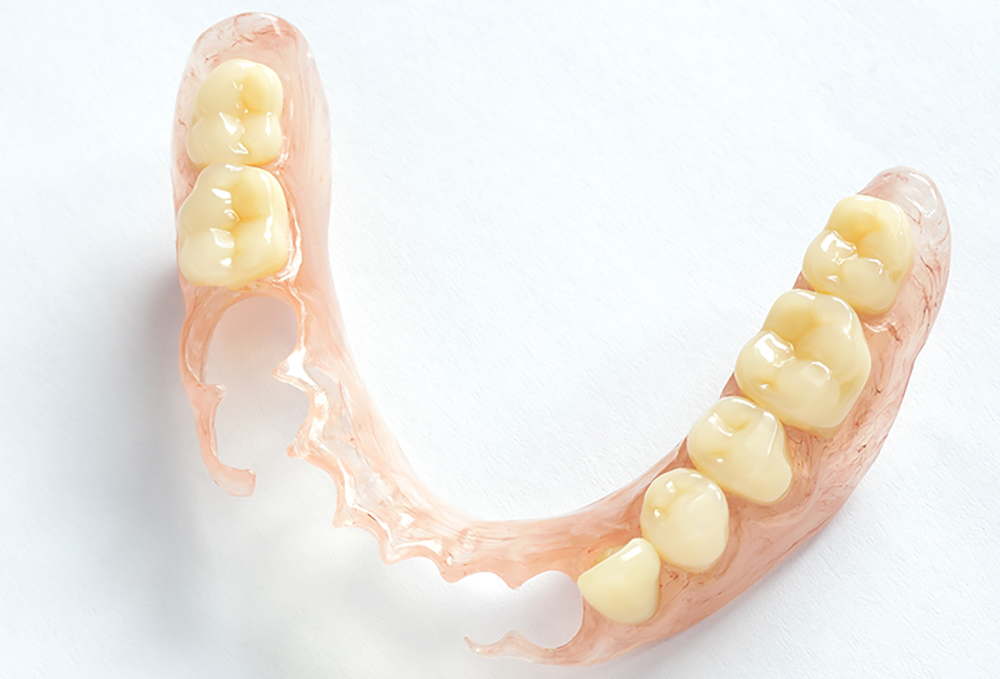 部分入れ歯：歯が残っている場合