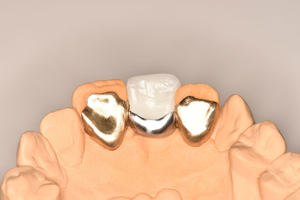 ヒューマンブリッジとは