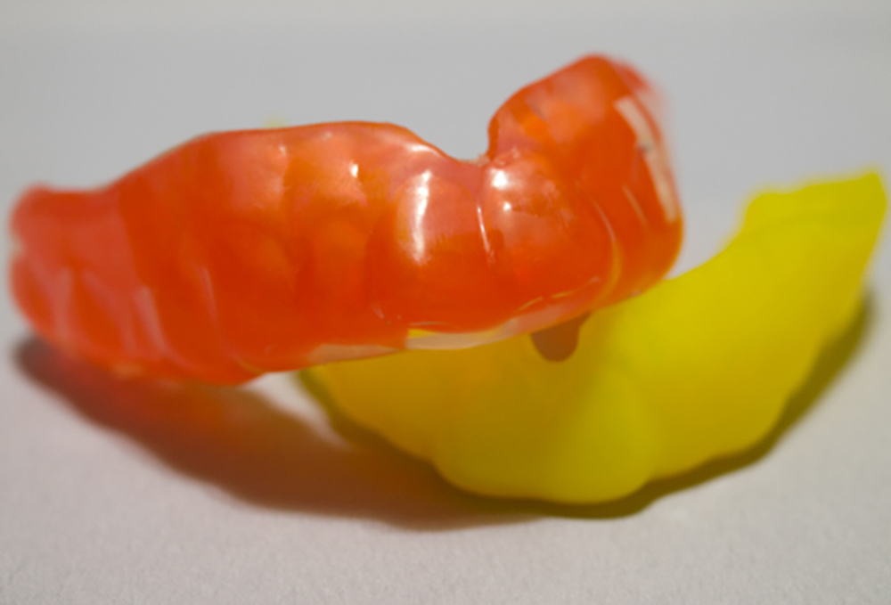 スポーツマウスガードとは